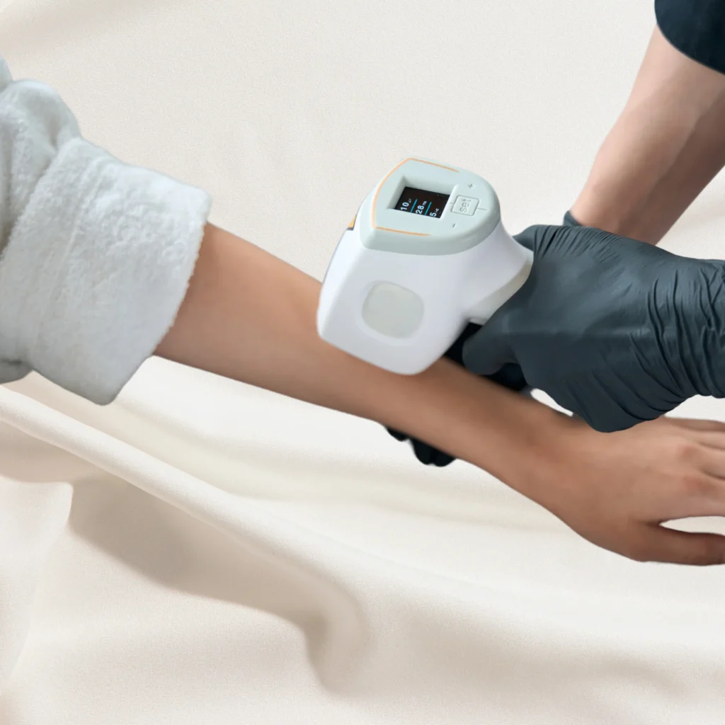 Full Hand Hair Removal in Kolkata