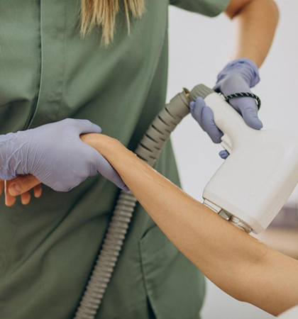 Laser treatment for hand hair removal in Kolkata